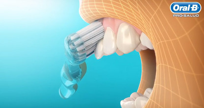 ¿Cómo es la correcta Técnica de Cepillado?